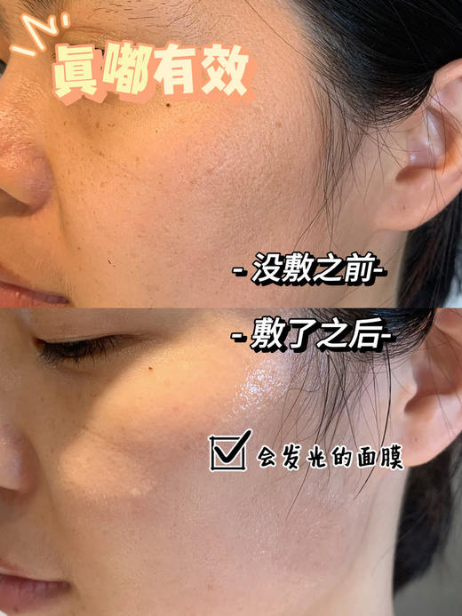 99到手4盒❗澳洲卖299元一盒！【澳洲Eaoron澳容水光针黑面膜】焕白去暗沉+补水保湿！🔻澳洲独产-卡卡杜李，天然的美白“活酵母”，VC含量=猕猴桃的50倍=橙子的100倍❗ 商品图11