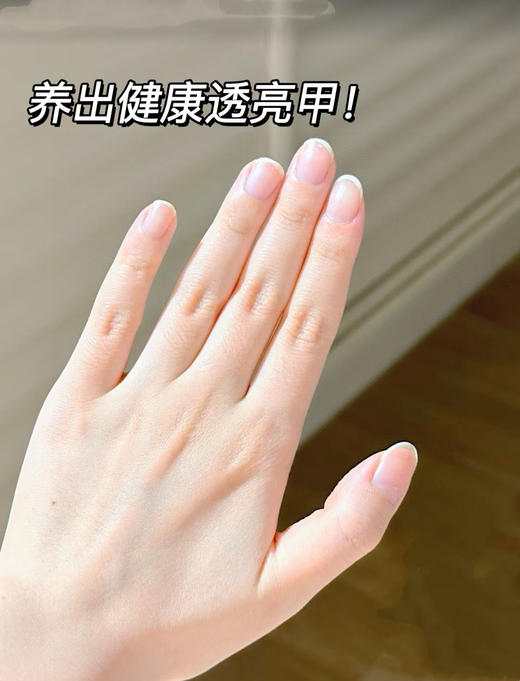 【百想皮泰国 灰甲膏】一抹即消，99%抑菌率十强渗透十长时效 8大草本搭配“醋酸氯已定"科学杀菌 商品图7