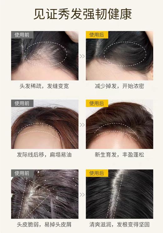 施华蔻防落发调理修护洗发露（女士适用）【宝库优选】 商品图5