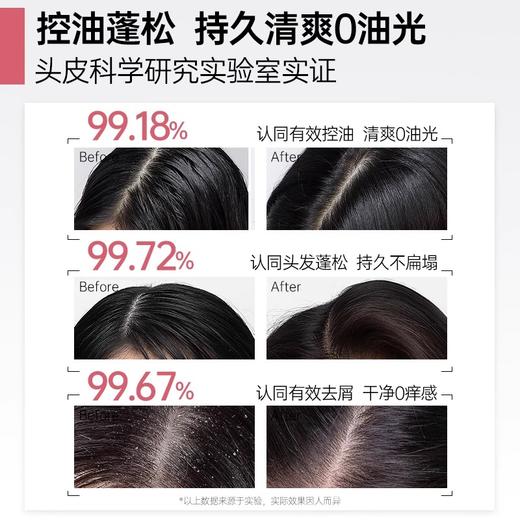 OHBT澳白臻萃洗发水控油去屑角蛋白氨基酸留香持久 商品图1