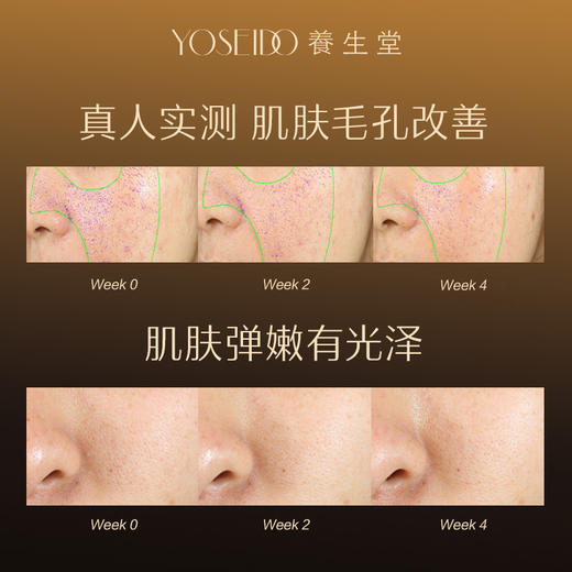 【全新升级】全新冬孕精华露（净颜焕肤）Pro 商品图4