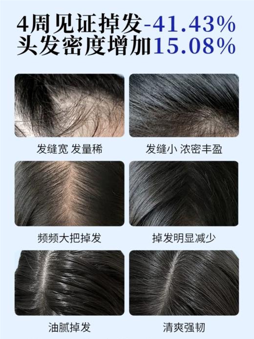 EHD防脱防断固发护理组合 洗发水/护发素/精华液 商品图1