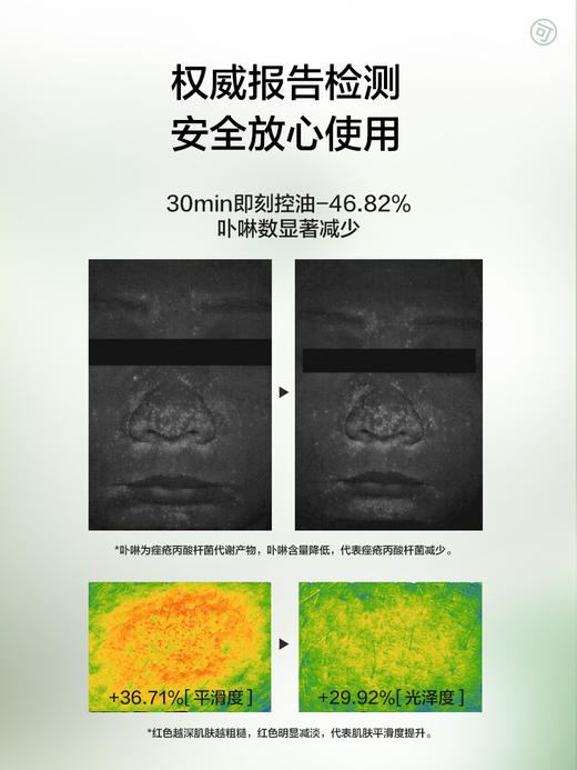 【29.9元任选5件】凡可啤酒酵母清爽控油水乳长效控油清爽舒缓祛痘平滑 商品图3