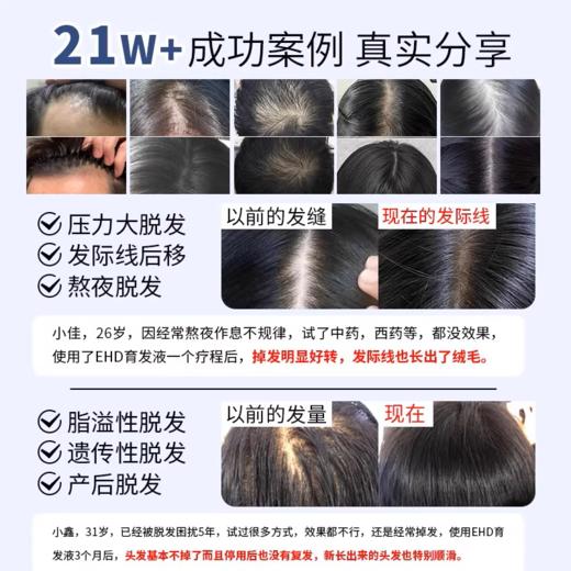 EHD防脱防断固发护理组合 洗发水/护发素/精华液 商品图11