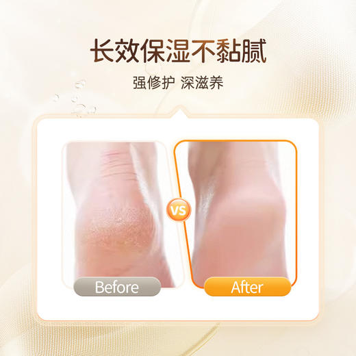悠斯晶（yuskin）日本维生素护手霜滋润保湿足部干裂修护膏脚后跟干裂膏足部防皲裂 80g/120g_YK 商品图10