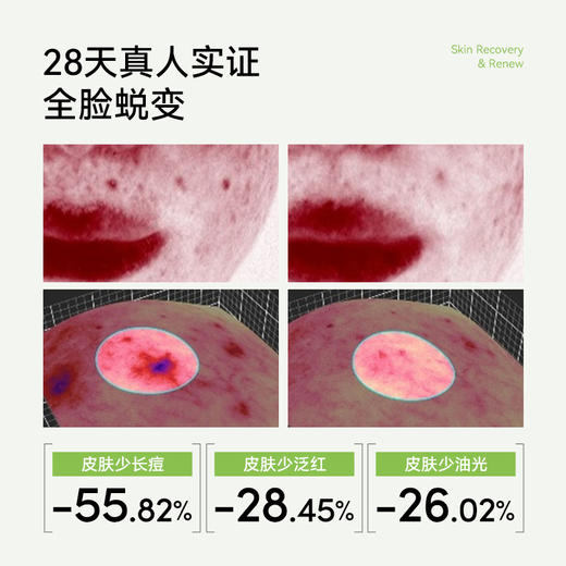 Metoday 双抗小绿盾 30粒 商品图4