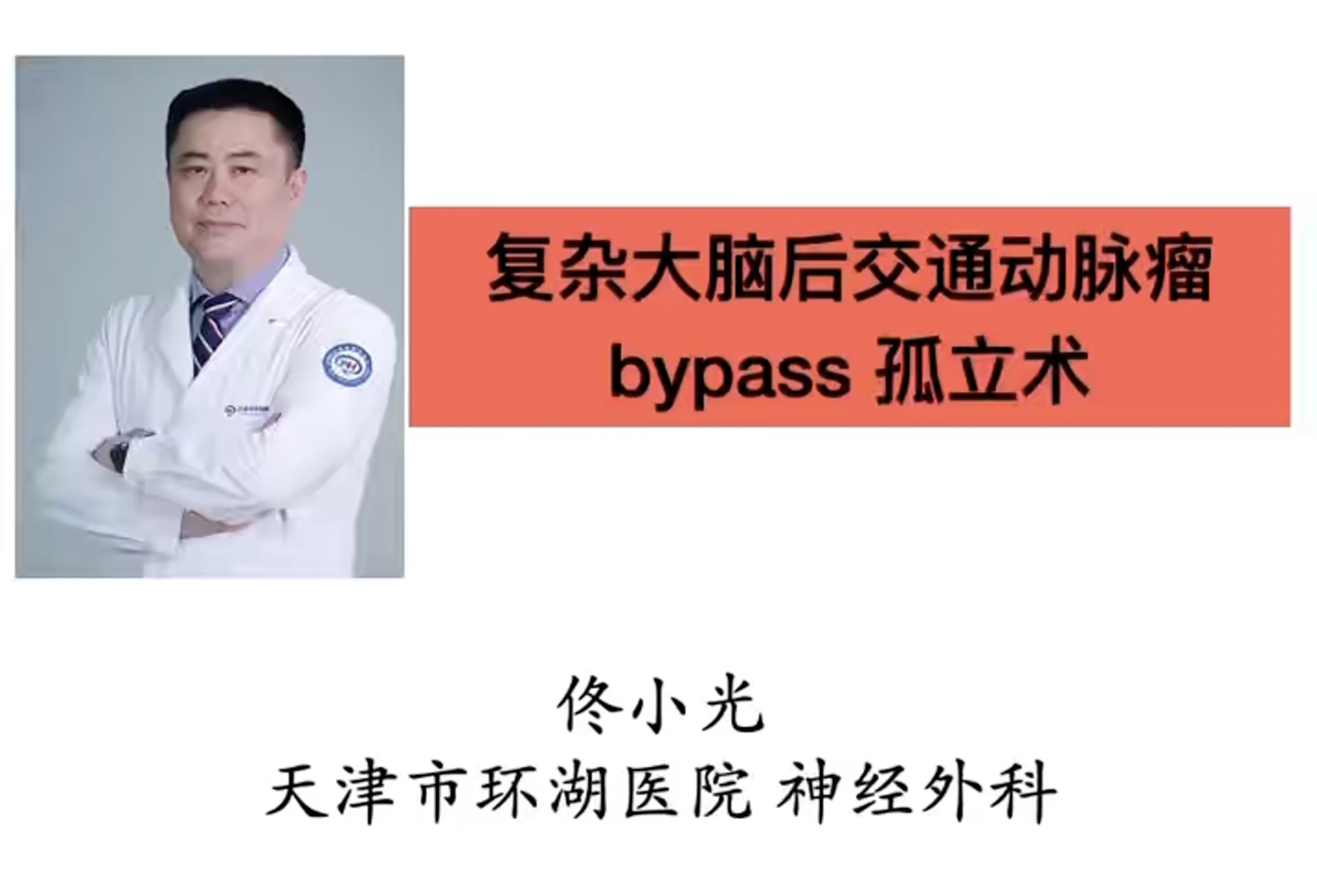 复杂大脑后交通动脉瘤