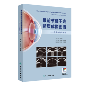 眼前节相干光断层成像图谱——影像分析与解读