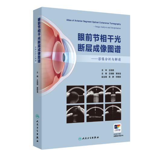 眼前节相干光断层成像图谱——影像分析与解读 商品图0