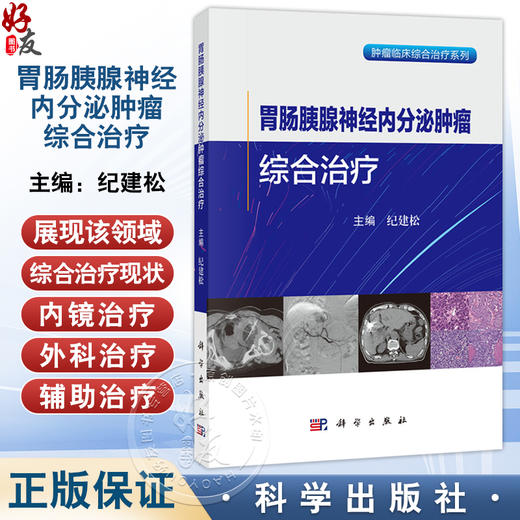 胃肠胰腺神经内分泌肿瘤综合治疗 纪建松 主编 适用肿瘤中心消化内科肝胆胰外科影像科胸外科疼痛科营养科专业医师 科学出版社 商品图0