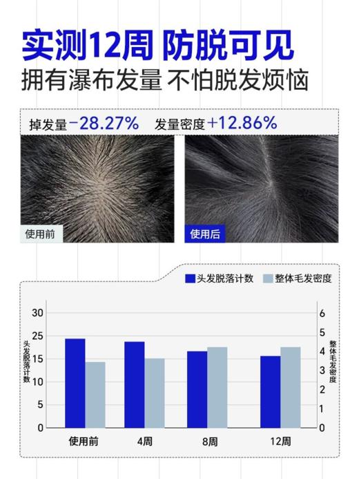 EHD防脱固发精华液（新包装）赠防脱洗发水中样 商品图1
