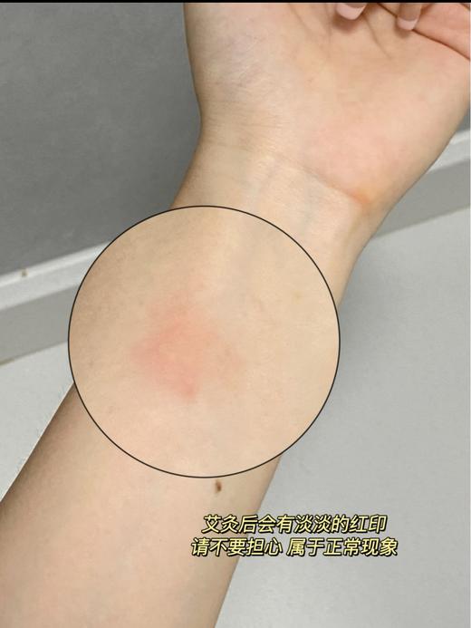 善坤缘大号 穴位灸（塑料盒艾烛）纸盒金艾贴 商品图8