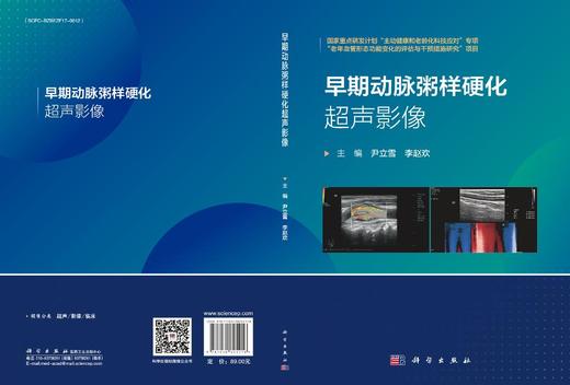 早期动脉粥样硬化超声影像 商品图3