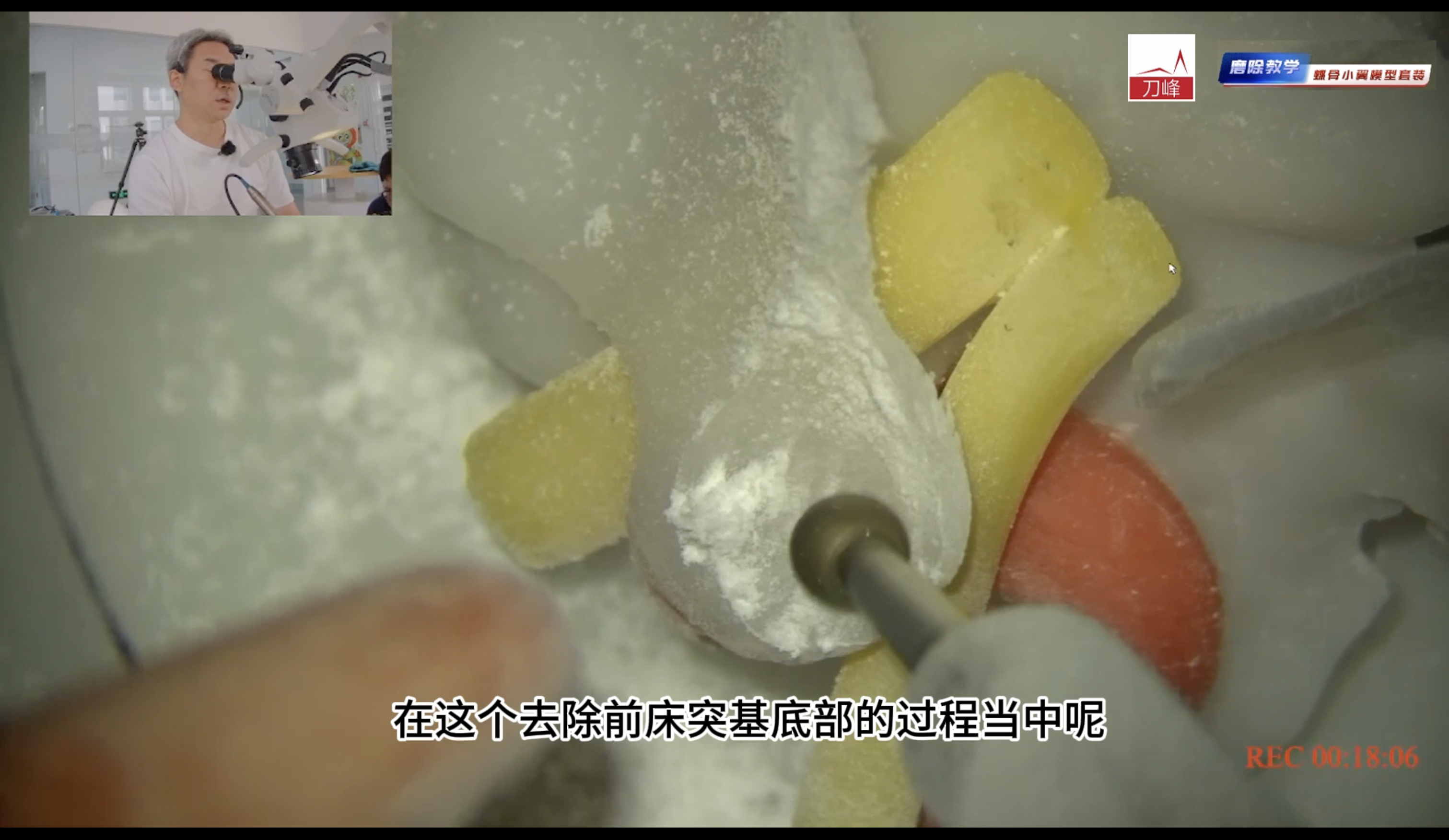 磨除介绍及教学