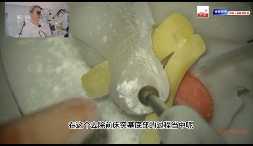 磨除介绍及教学 商品图0