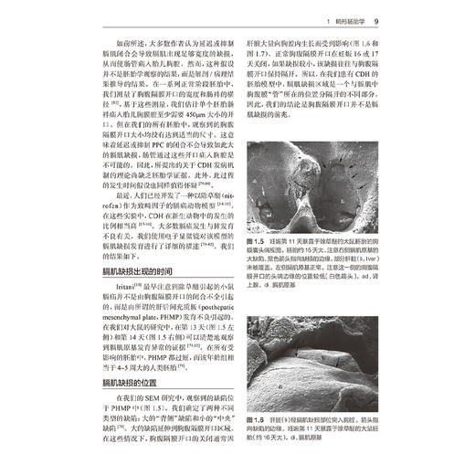 新生儿外科学 第4四版 舒强 钭金法 主译 阐述了新生儿外科疾病的特点 涵盖诊疗要点 临床精华 鉴别诊断等 儿科学 人民卫生出版社 商品图4