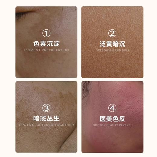 【限时买1送4】赛隆悦佳传明酸美白祛斑精华液（免费试用） 商品图2