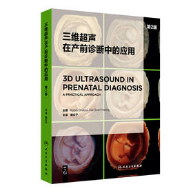 三维超声在产前诊断中的应用 第2版