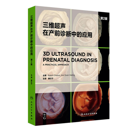 三维超声在产前诊断中的应用 第2版 商品图0