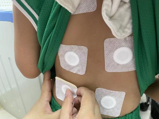 中医三伏贴/天灸  买三次送二次（共5次）（仅到黄村社卫使用） 商品图0