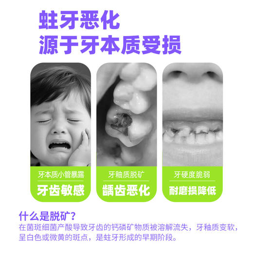 【牙医专享】氟钙双护乳牙期/换牙期分段儿童特护牙膏促进牙齿再矿化牙膏 商品图2