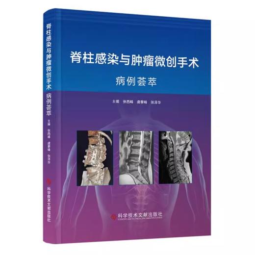 脊柱感染与肿瘤微创手术病例荟萃 张西峰 虞攀峰 张泽华 商品图0
