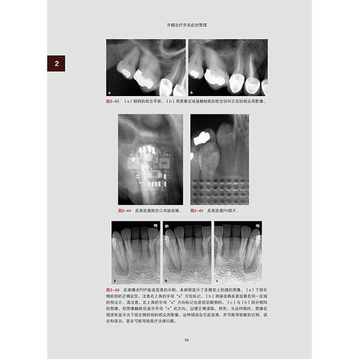 牙髓治疗并发症的管理 赵今 连冰洁 诊断和治疗过程中并发症 影像学检查过程中失误清理和成形 辽宁科学技术出版社9787559141682 商品图4