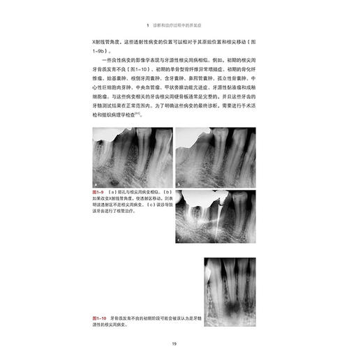 牙髓治疗并发症的管理 赵今 连冰洁 诊断和治疗过程中并发症 影像学检查过程中失误清理和成形 辽宁科学技术出版社9787559141682 商品图3