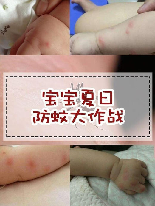 日本KINCHO金鸟防蚊贴婴儿童宝宝驱蚊 贴天然植物防蚊孕妇可用24枚 商品图5