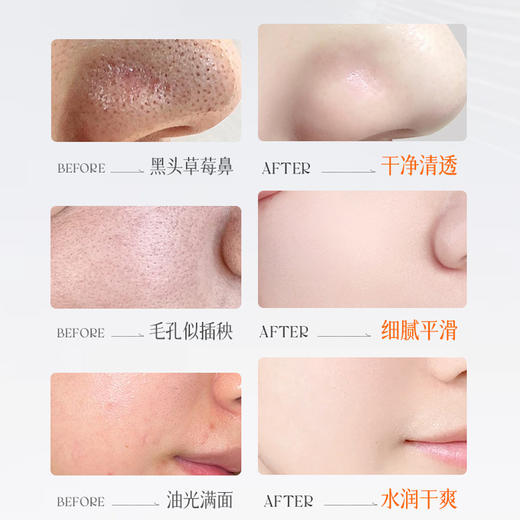 【MACK ANDY--净肤双色清洁泥膜】U区摩洛哥白泥平衡油脂收毛孔、T区摩洛哥黑泥深层清洁去黑头、控油舒缓温和配方、双色双护双膜力、黑头毛孔无处可藏！ 商品图4