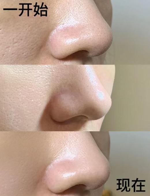 国货老字号水韵梦H芪净透洁面乳男女通用 商品图12