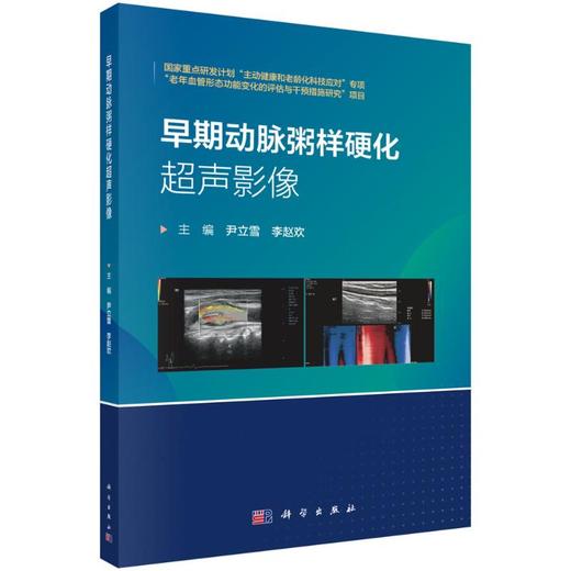 早期动脉粥样硬化超声影像 商品图0