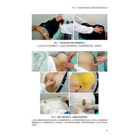 骨髓标本检验诊断与报告 卢兴国 马顺高 叶向军 介绍各种检验骨髓标本的采集规范 临床医学 骨科学 9787117379113人民卫生出版社 商品图4