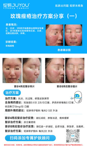 玫瑰痤疮治疗方案分享（一）