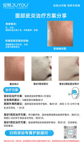 玫瑰痤疮治疗方案分享（三）