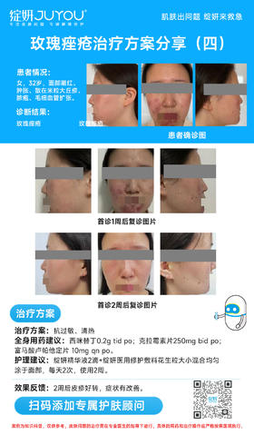 玫瑰痤疮治疗方案分享（四）