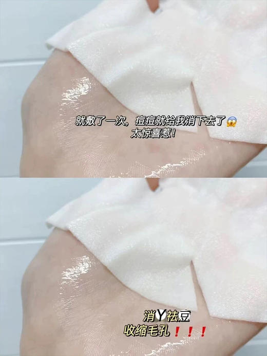 REJURAN韩国丽珠兰回春面膜5片  保湿补水提亮修复 商品图1