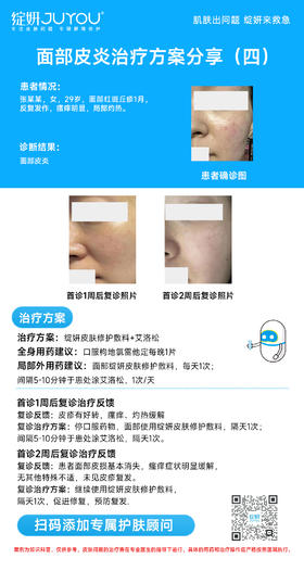 面部皮炎治疗方案分享（四）