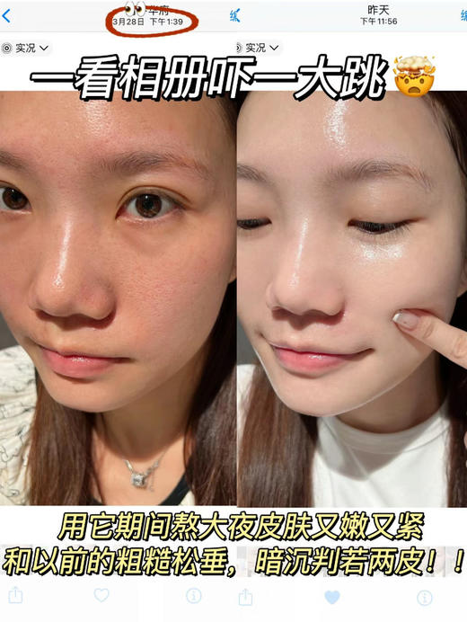 【多妈团购 RENESAS虾青素肌肽精华液套盒共122支】糖化氧化双杀!1支=10瓶普通精华，保湿、祛黄、抗糖，毛孔粗大，细纹频生，垮脸直接闭眼入-金克丝 商品图7