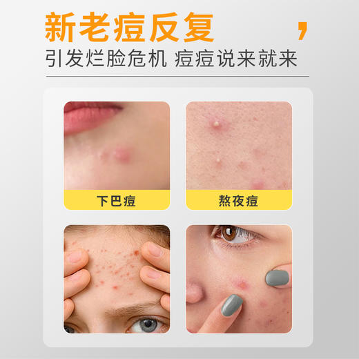 【痘痘急救隐形贴】片仔癀祛痘贴| 轻薄隐形贴肤透气改善痘痘肌 隐形净痘贴 商品图1