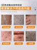 【国货之光】片仔癀牌祛痘膏 点痘笔祛痘修护膏深层修护淡化痘印 商品缩略图3