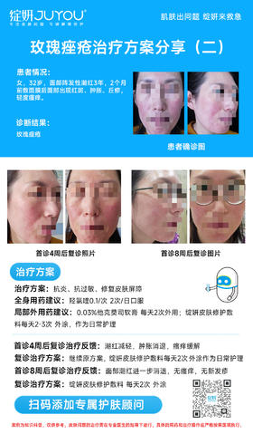 玫瑰痤疮治疗方案分享（二）