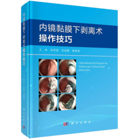 内镜黏膜下剥离术操作技巧 张学彦,吕成倩,崔希威 编