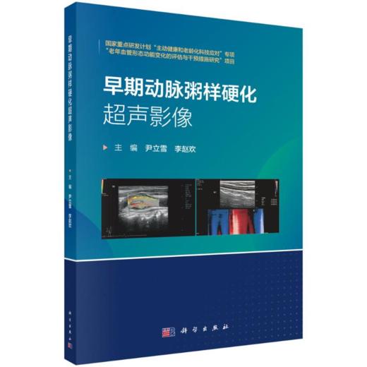 早期动脉粥样硬化超声影像 商品图0