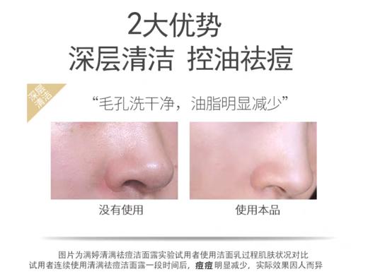 满婷清满祛痘洁面乳【宝库优选】 商品图3