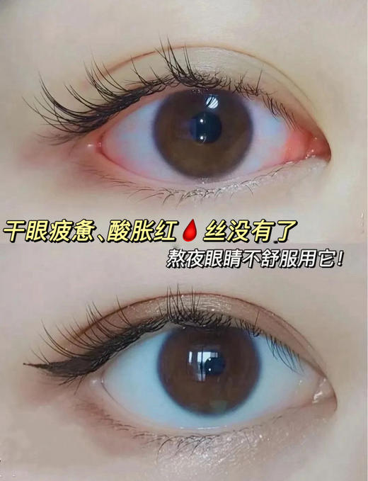 ✨德国HEALMUSZ蓝莓叶黄素滴眼液 商品图2