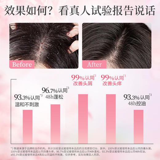 阿道夫祛屑舒爽洗发水420ml+护发素420ml+沐浴露420ml 洗护沐套装赠送60ml【XPTX】 商品图6