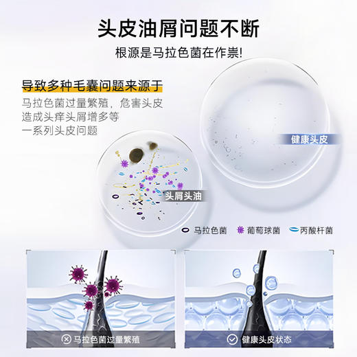 Dr.Eyemo爱茉博士二硫化硒洗发水 去屑控油护发男女防断发膏露 商品图4