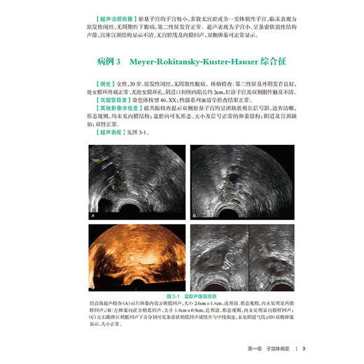 全2册 乳腺疾病超声图解100例+妇科疾病超声图解100例 住院医师超声医学PBL教学培训系列教程 超声诊断典型病例 人民卫生出版社 商品图4