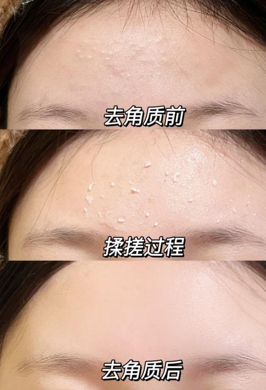 ✨👉🏻皮肤吸收力暴增90%的秘密⚠️大牌院线同款配方👍🏻黑头死皮一扫光！  【颜素真兰花去角质搓泥啫喱】 商品图2